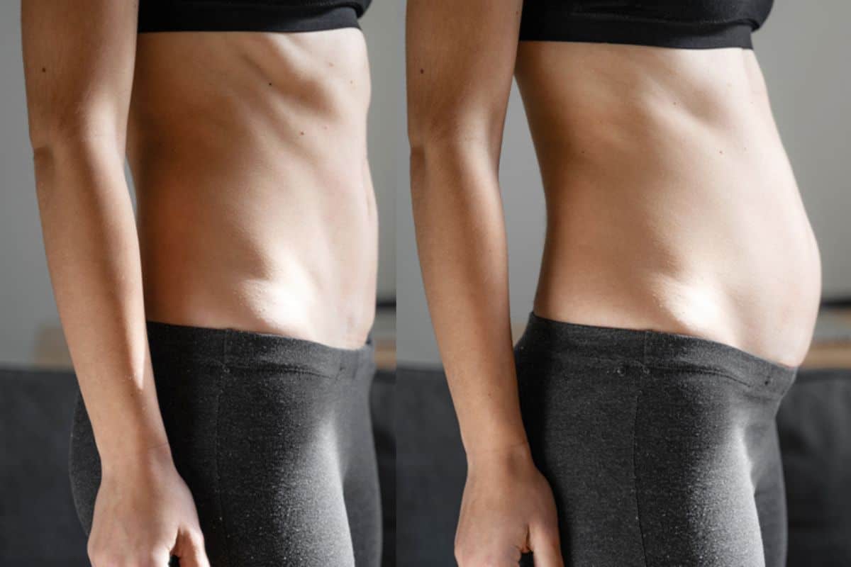 How long does diastasis recti take to improve Gloucestershire?