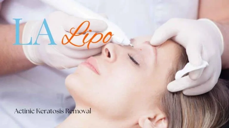 Woman receiving Actinic Keratosis Removal Treatment Gloucestershire