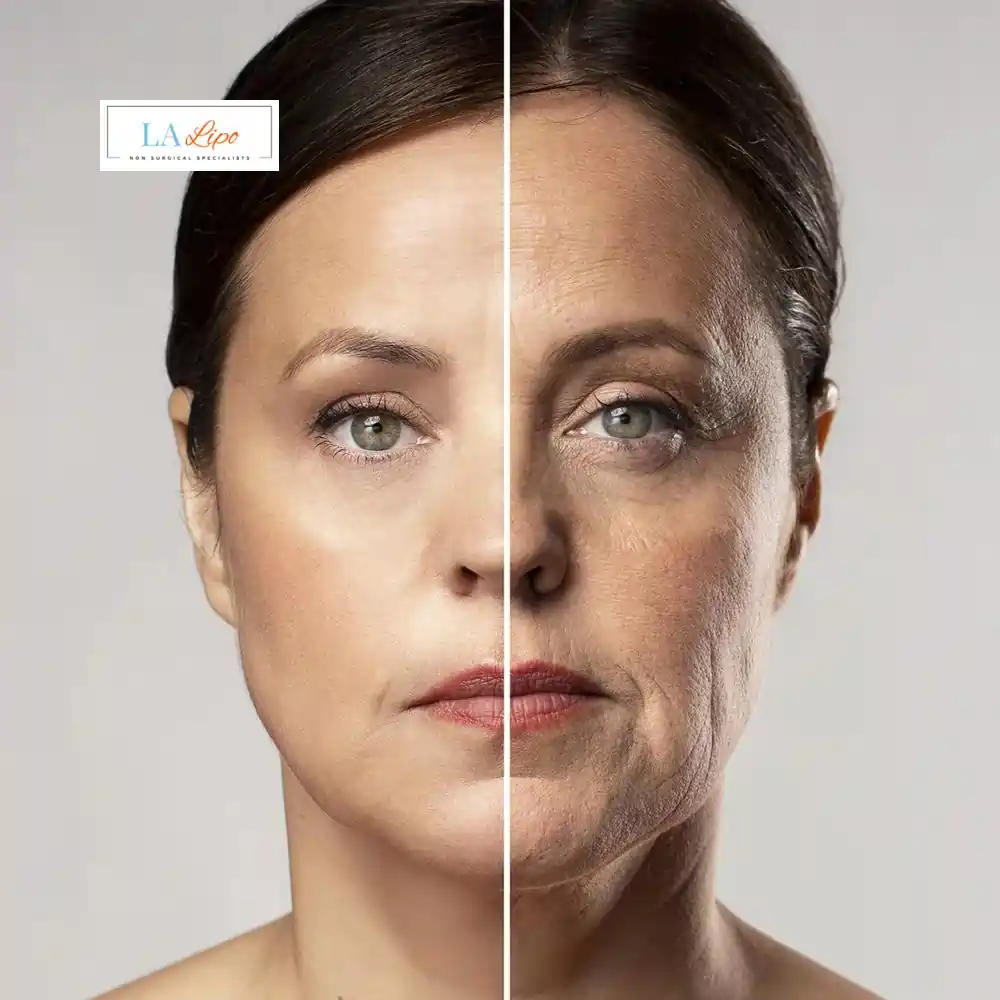 How Can You Tell If Non-Surgical Skin Tightening Is Right for You Gloucestershire?