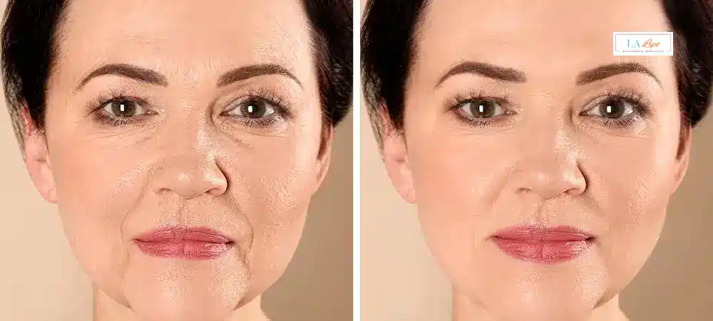How Long Does It Take to See Results and How Long Do They Last Gloucestershire?