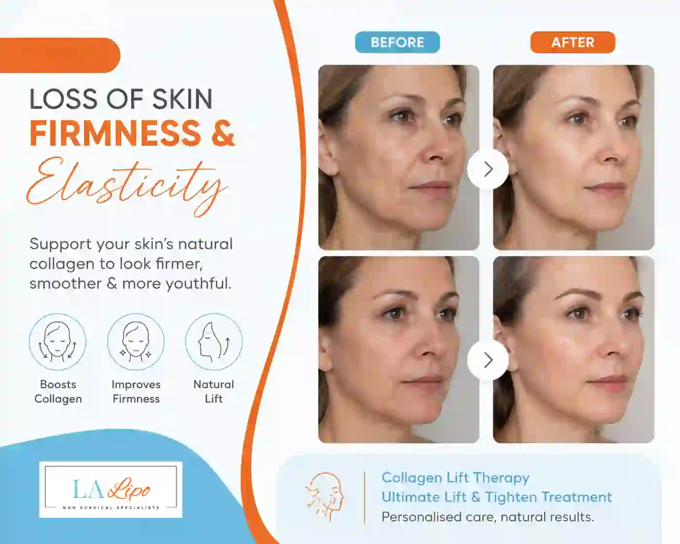 Sign #7: Loss of Skin Firmness and Elasticity Gloucestershire