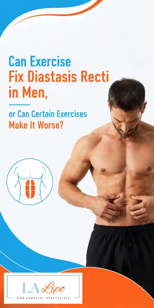 Can Exercise Fix Diastasis Recti in Men, or Can Certain Exercises Make It Worse Gloucestershire?